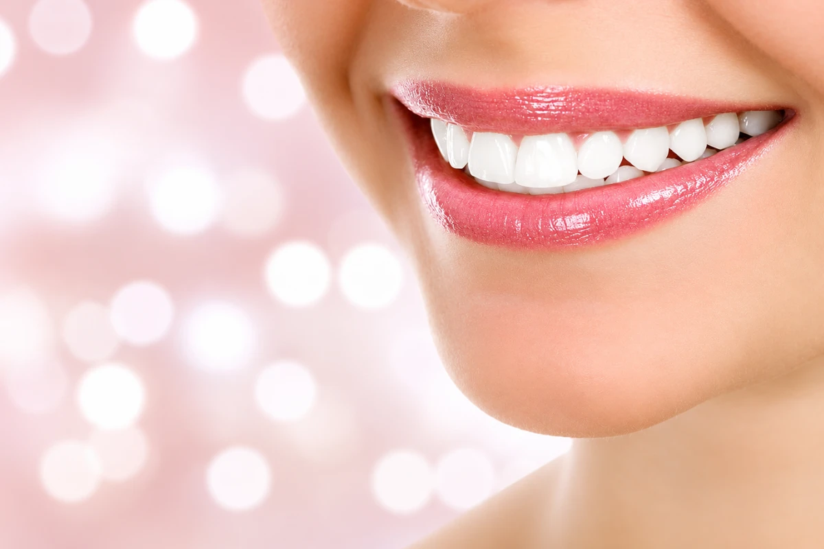 Close-up of a woman's bright, natural-looking smile showcasing white, healthy restored teeth.